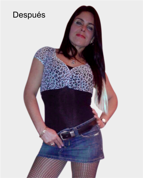 despues de cirugia bariatrica