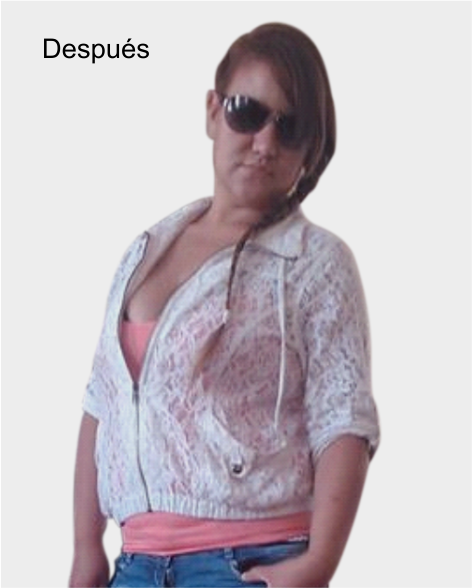 despues de cirugia bariatrica