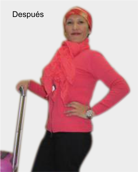 despues de cirugia bariatrica