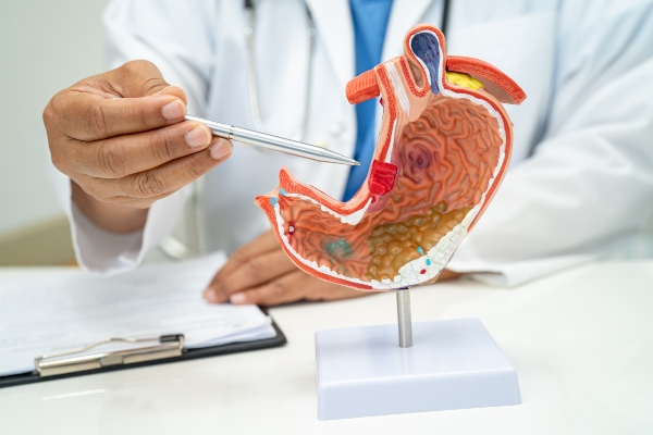 que es el bypass gastrico y para que sirve